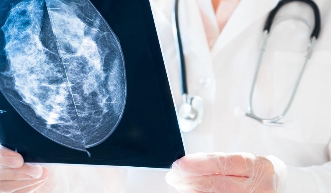 Implementarán inteligencia artificial para la detección oportuna del cáncer de mama
