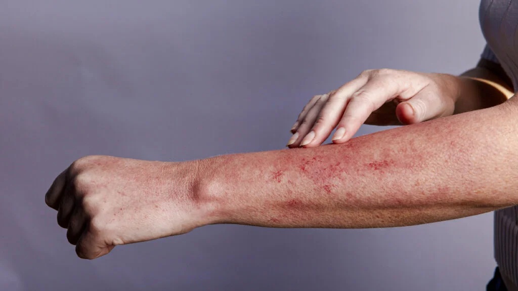 Aún falta tener más conciencia sobre los riesgos de contraer VIH