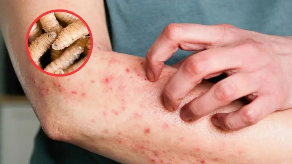 Brindan oportuna atención a casos de gusano barrenador